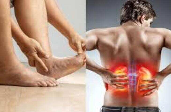 कहीं आपके पैरों में ये बदलाव तो नहीं दिख रहे? किडनी फेलियर के ऐसे संकेत जिन्हें नजरअंदाज करना पड़ सकता है भारी