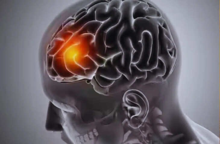 जानिए कौन सी है वो 5 खतरनाक आदतें जो आपके दिमाग को हर दिन कर रही कमजोर, आज से ही करे इन्हें छोड़ने की शुरुआत 