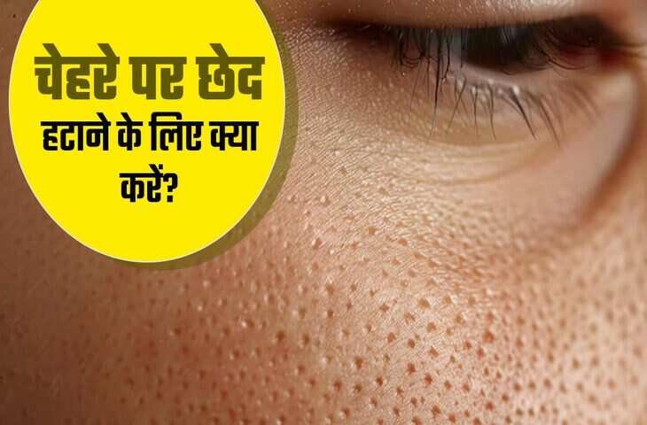 देसी नुस्खे जो कम करेंगे ओपन पोर्स और देंगे चमकदार त्वचा, इस्तेमाल करें रोज और खुद देखें फर्क