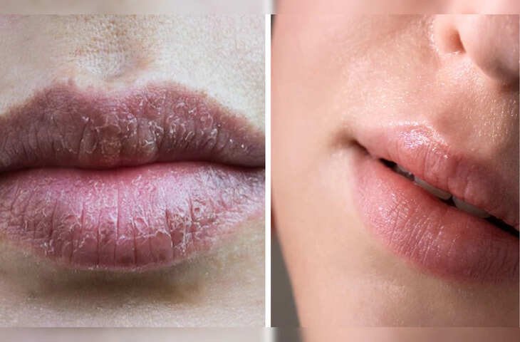केमिकल वाली लिपस्टिक को कहें अलविदा! घर पर बनाएं 100% नेचुरल पिंक लिपस्टिक, होंठों में आएगी नैचुरल सॉफ्टनेस और चमक