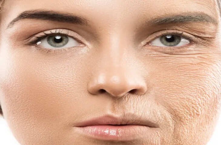 'ढीली स्किन और चेहरे पर झुर्रिया...' किस विटामिन की कमी से जल्दी बूढ़ा हो जाता है शरीर ? जाने कैसे पूरी होगी कमी 