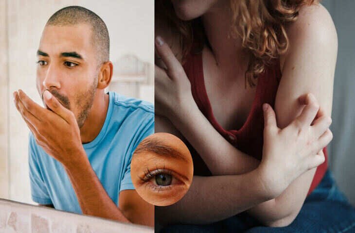 चेहरे पर बदलाव बता सकते हैं किडनी की समस्या! जानें किन संकेतों को नज़रअंदाज़ करना खतरनाक